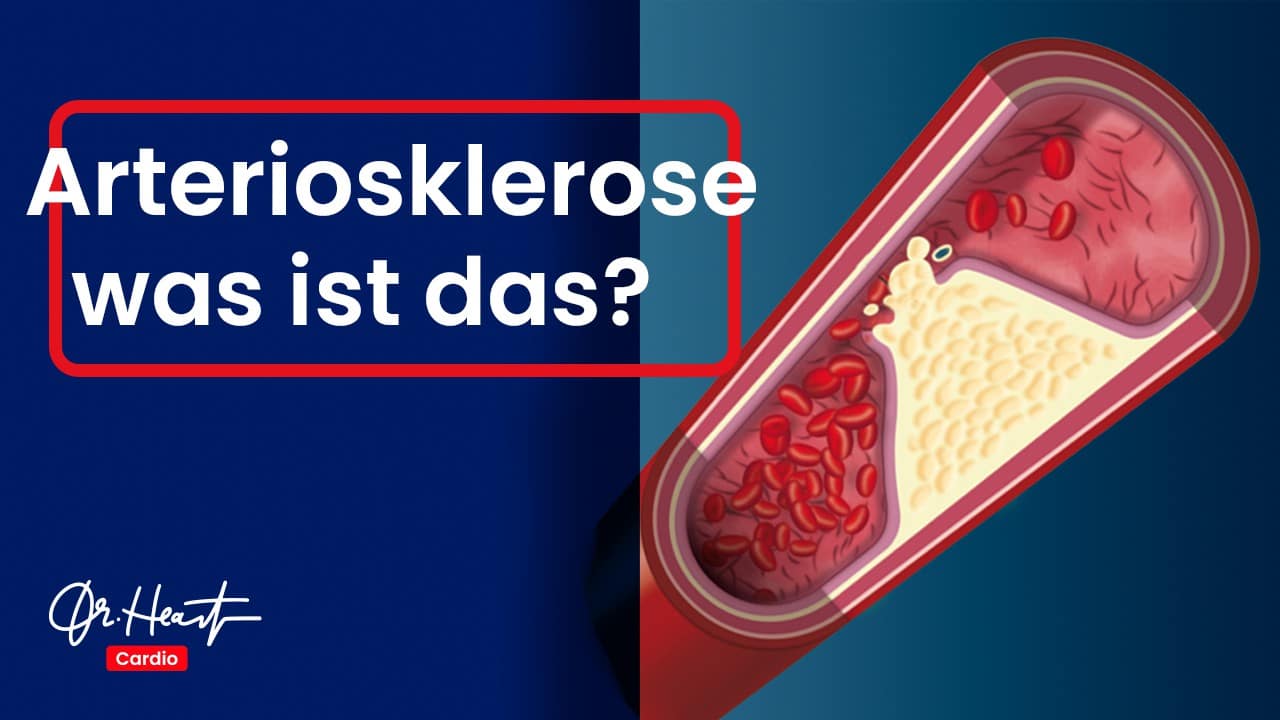 Arteriosklerose - Die Bedeutendste Erkrankung überhaupt? – Dr. Heart