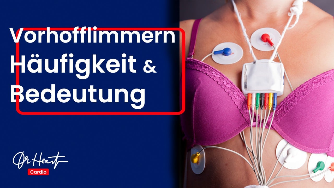 Vorhofflimmern Haufigkeit Und Bedeutung Dr Heart